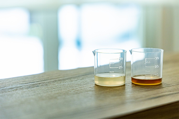 薄毛ケア専門 美容室レンテ 施術の流れ