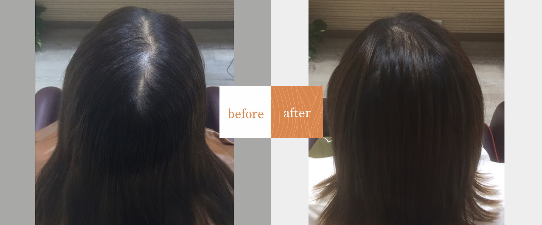薄毛ケア専門サロン シャン美容室改善事例