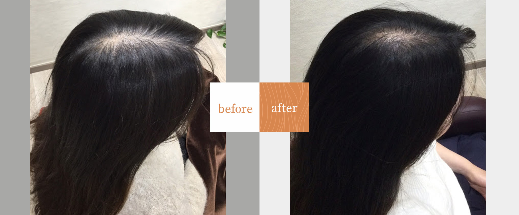 薄毛ケア専門サロン シャン美容室改善事例